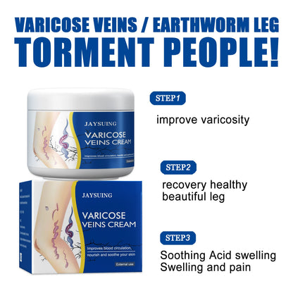 Leg Relief Varicose Veins Cream for Pain and Swelling Body Care Lotions Comfort Skin Care- CU