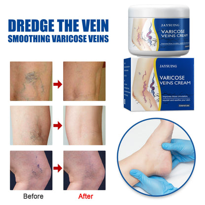Leg Relief Varicose Veins Cream for Pain and Swelling Body Care Lotions Comfort Skin Care- CU