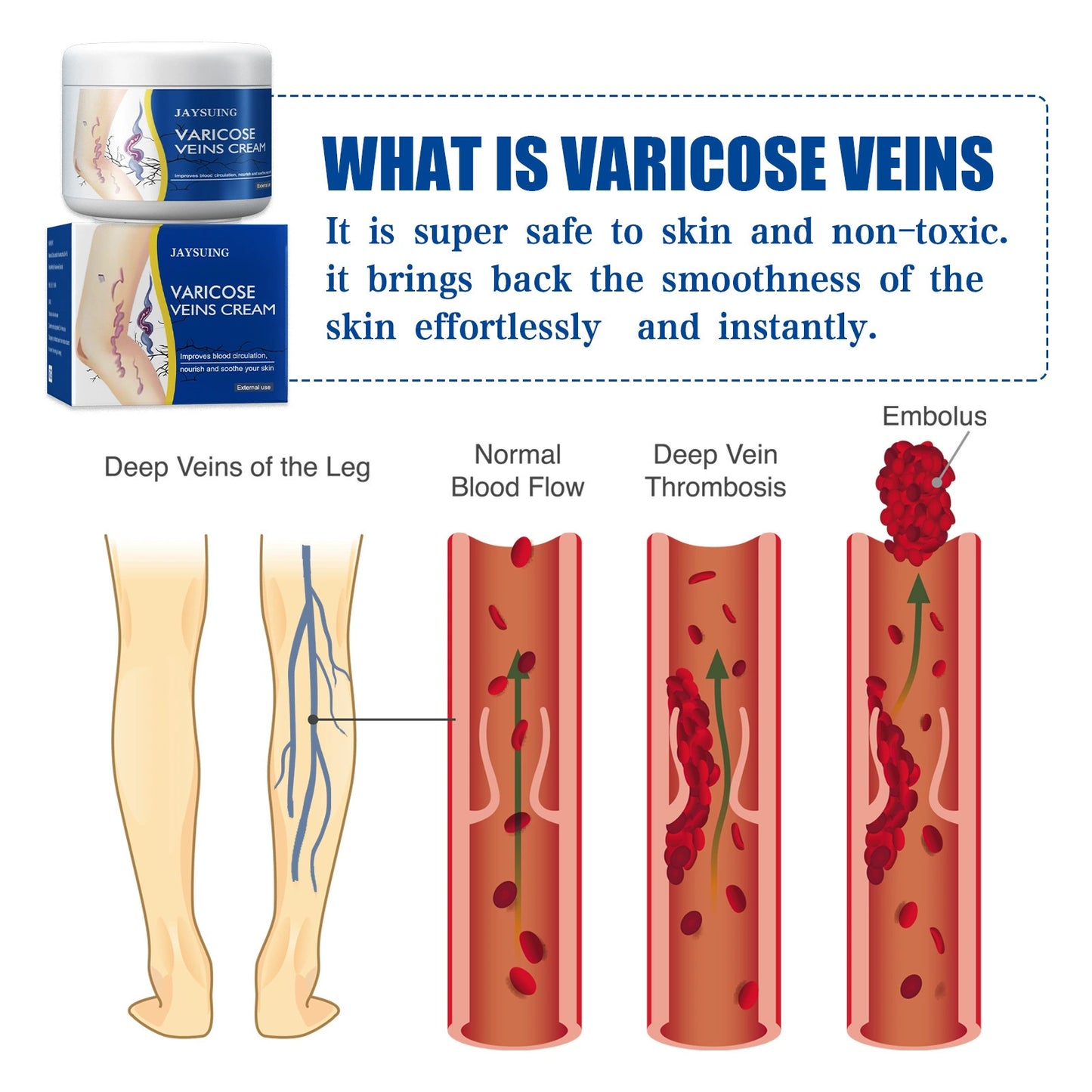 Leg Relief Varicose Veins Cream for Pain and Swelling Body Care Lotions Comfort Skin Care- CU