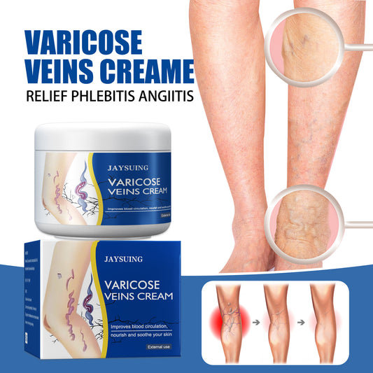 Leg Relief Varicose Veins Cream for Pain and Swelling Body Care Lotions Comfort Skin Care- CU