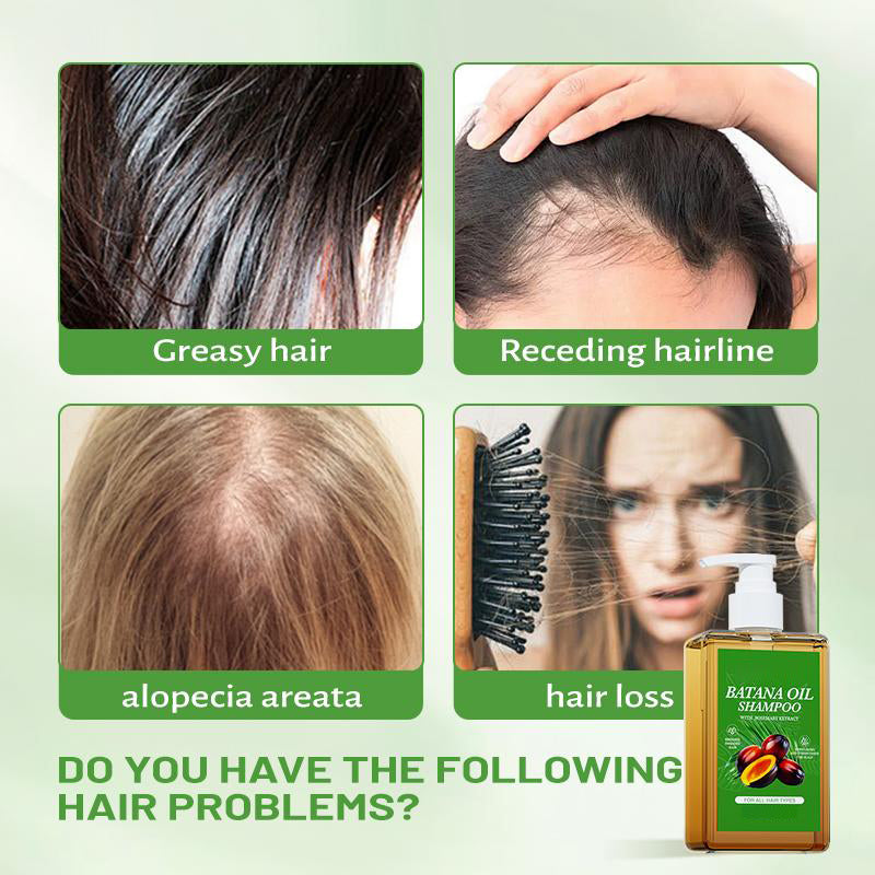 Batana Oil Shampoo -Promote Hair Growth, Strengthening-CU